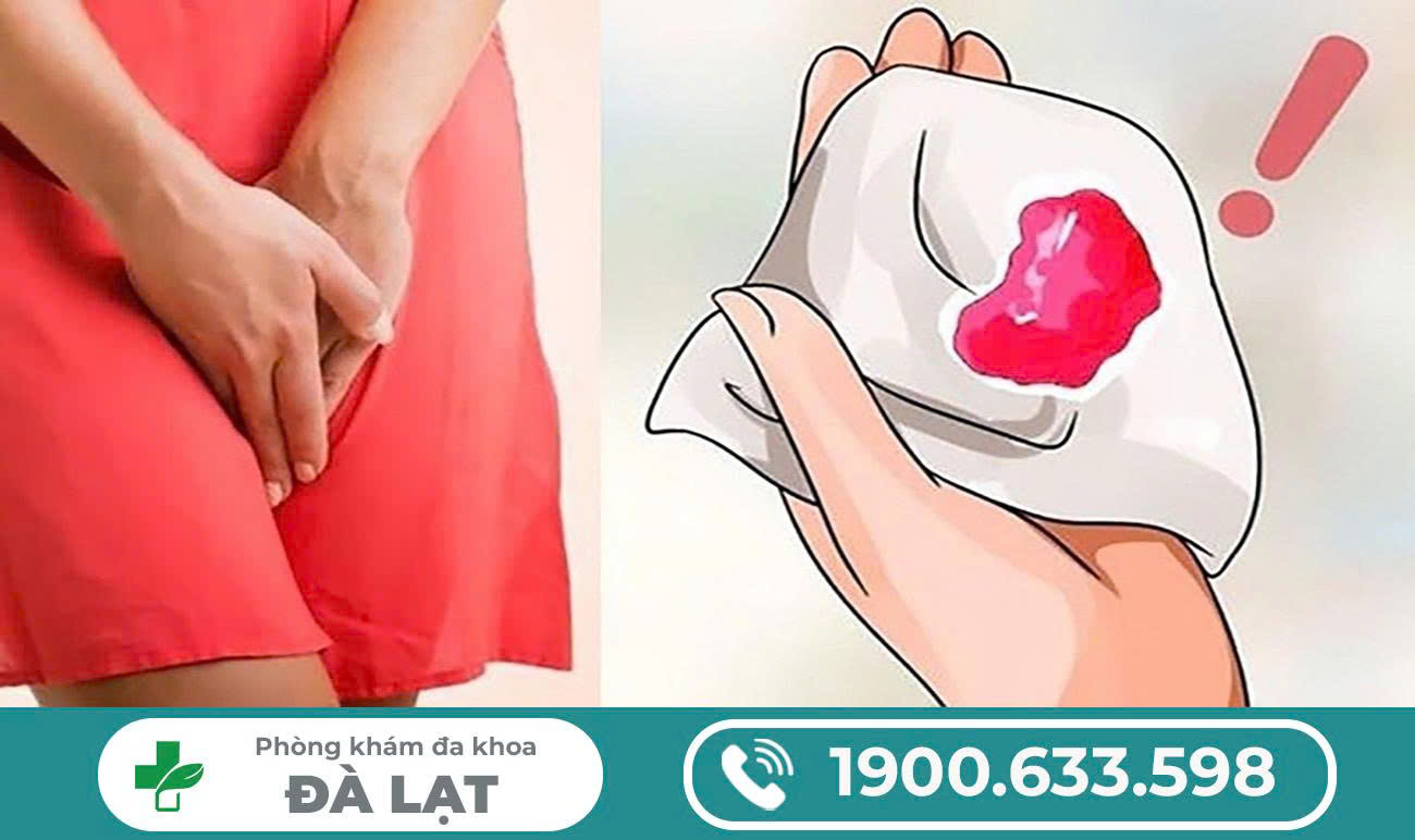 Hình ảnh minh họa